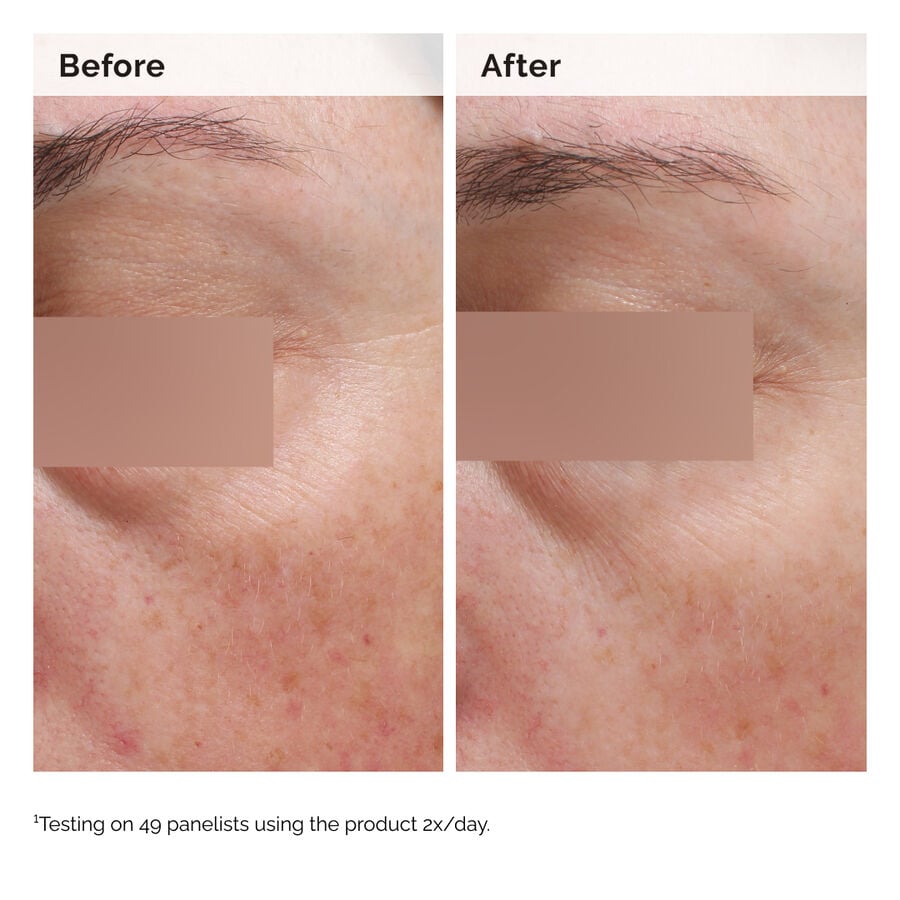 niacinamide-5-face-and-body-emulsion-c4 2024-08-23-ORD-Nia-5pct-Face-Body-B-A-Elasticity-Global-02-1x1.jpg