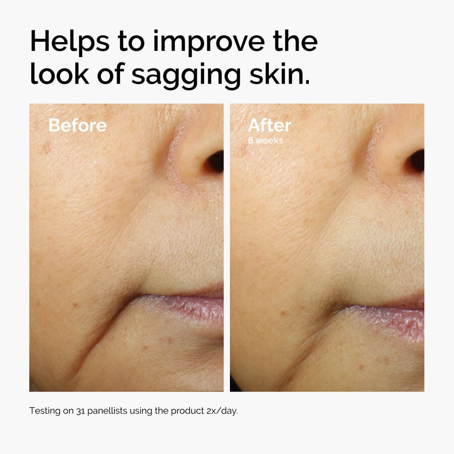 caffeine-3-escin-1-face-serum-y2 ord-caffeine-3pct-escin-1pct-face-serum-before-after-sagging.jpg