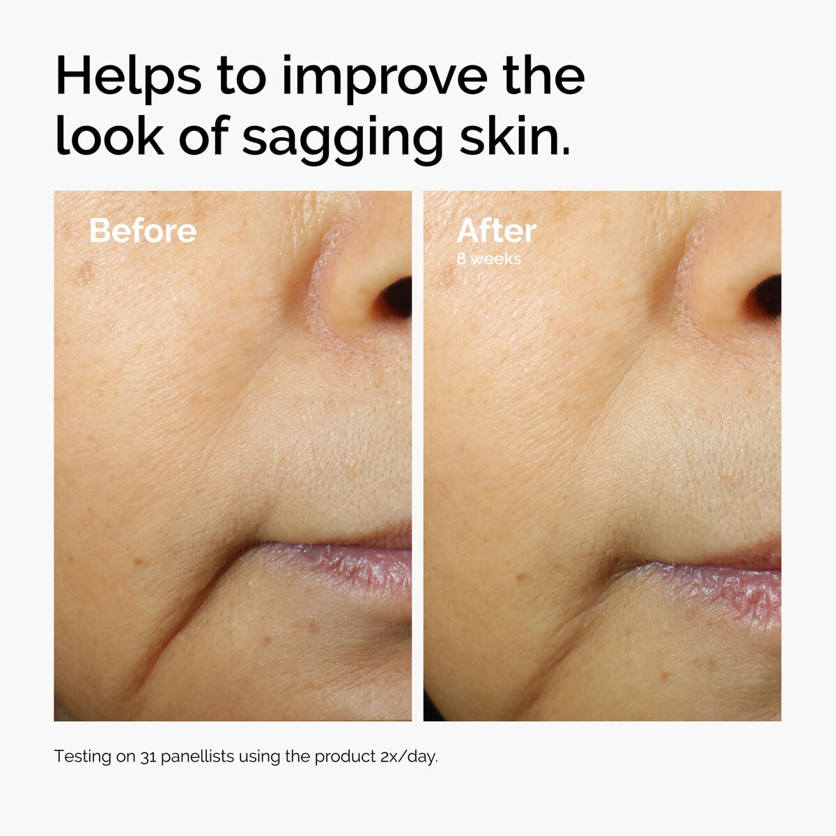 caffeine-3-escin-1-face-serum-y2 ord-caffeine-3pct-escin-1pct-face-serum-before-after-sagging.jpg
