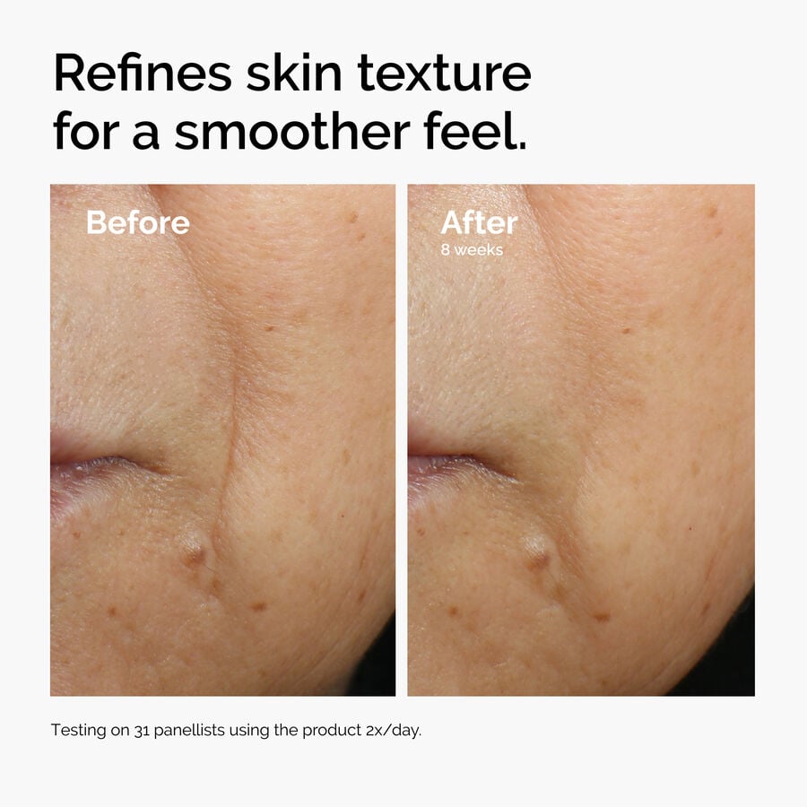 caffeine-3-escin-1-face-serum-y2 ord-caffeine-3pct-escin-1pct-face-serum-before-after-texture.jpg