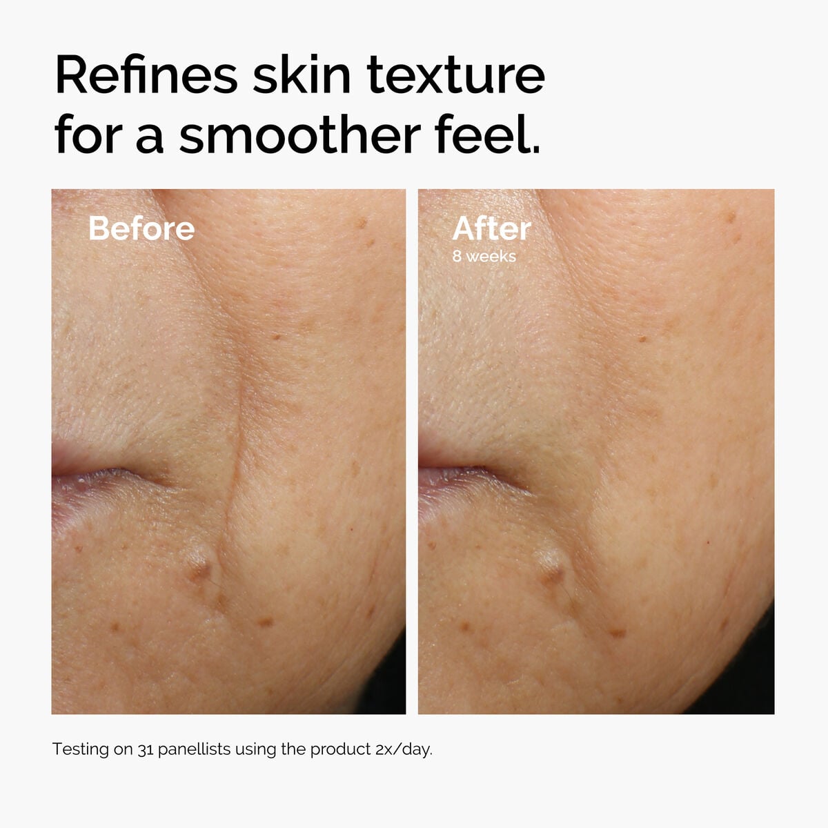 caffeine-3-escin-1-face-serum-y2 ord-caffeine-3pct-escin-1pct-face-serum-before-after-texture.jpg