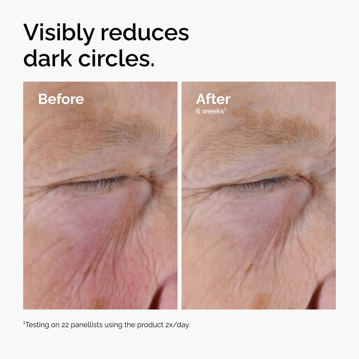 caffeine-solution-5-egcg-eye-serum-z5 ord-caffeine-solution-egcg-dark-circles-before-after.jpg