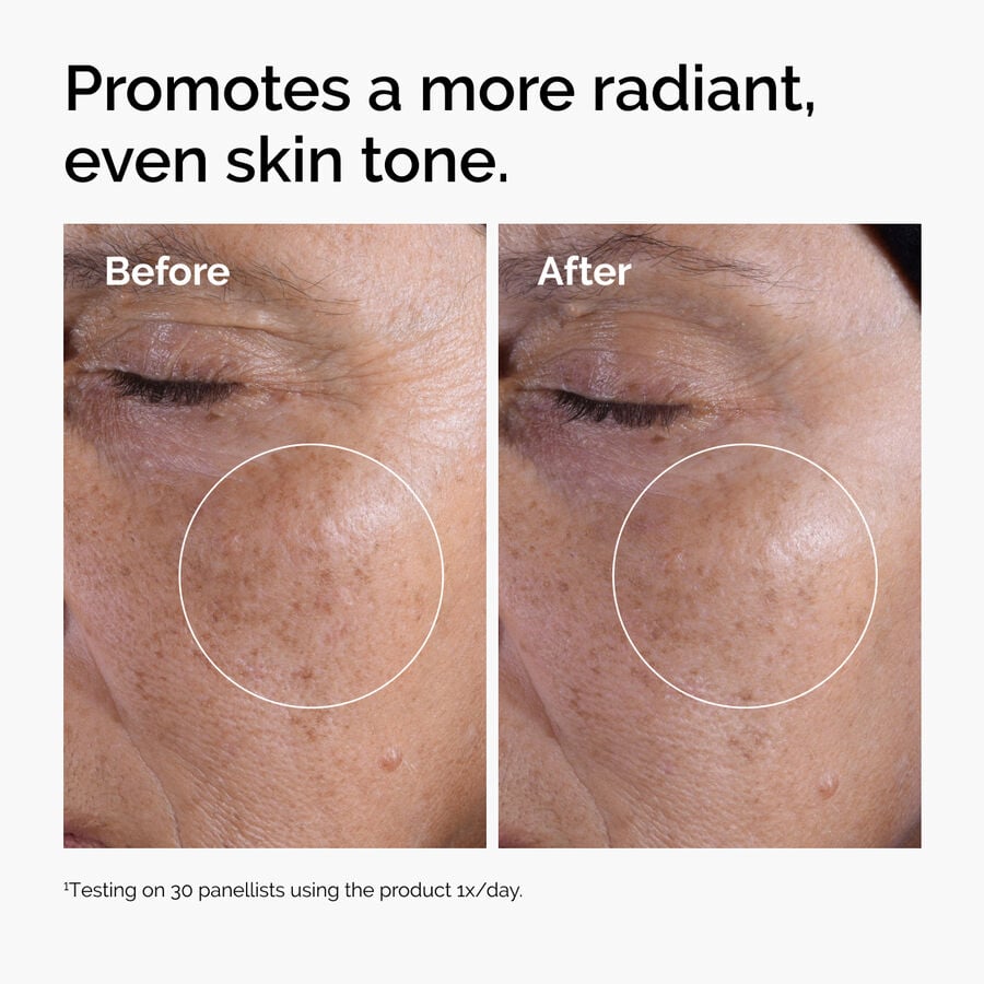 glycolic-acid-7-exfoliating-toner-i1 ord-glycolic-before-after-radiance.jpg