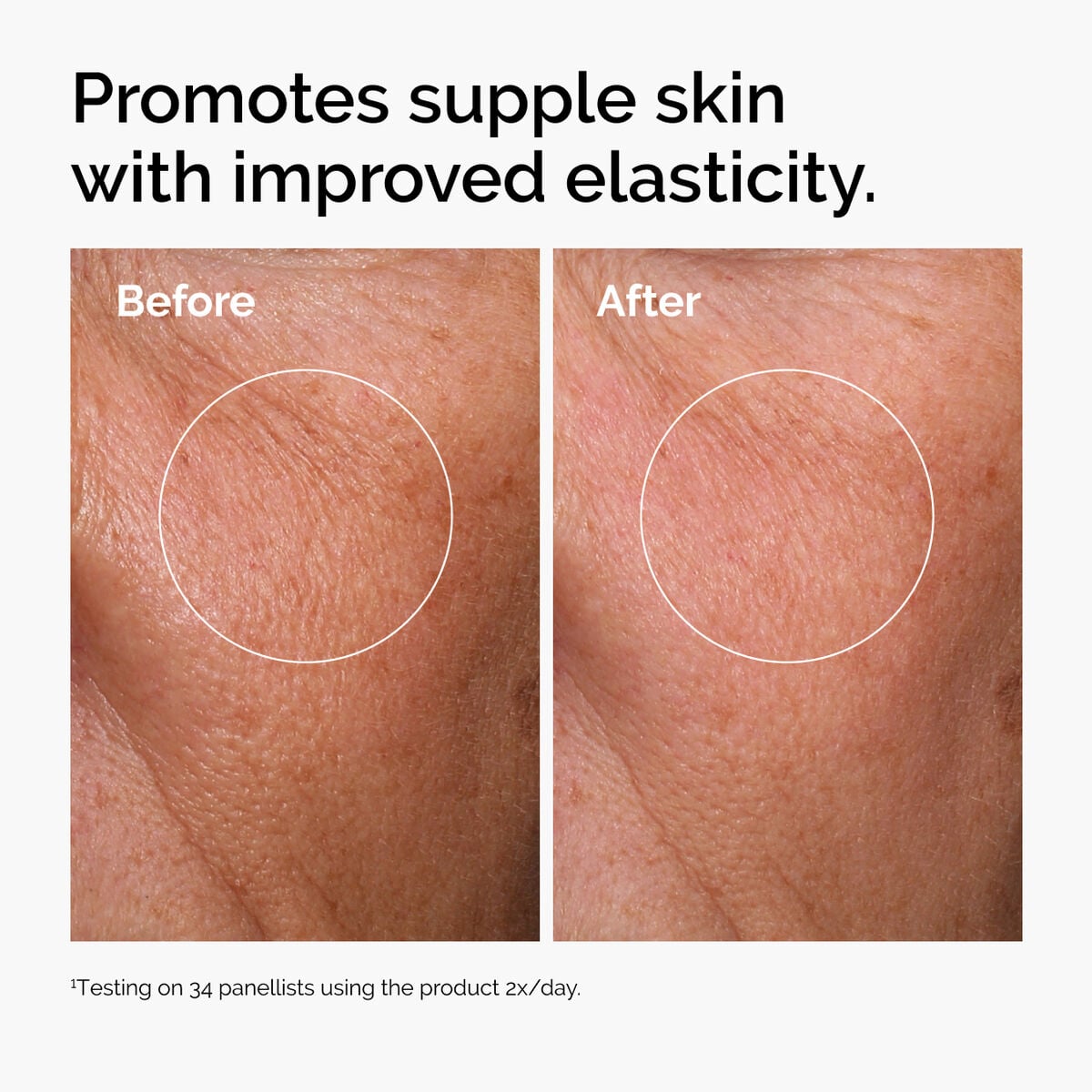 hyaluronic-acid-2-b5-with-ceramides-i3 ord-hyaluronic-acid-2pct-b5-hydrating-serum-before-after-elasticity.jpg