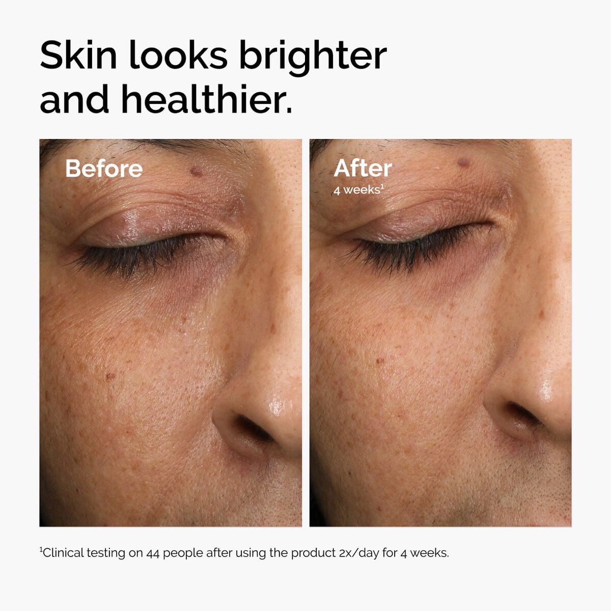 multi-antioxidant-radiance-serum-g8 ord-mars-before-after-healthy.jpg
