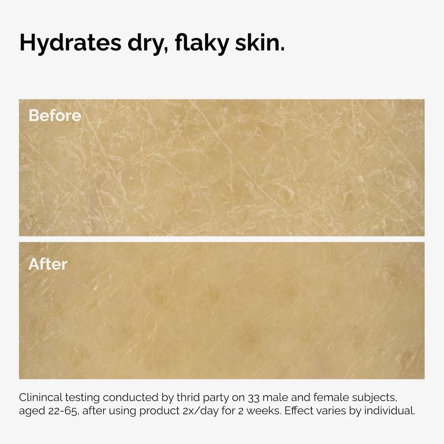 the-body-care-collection-y1 ord-natural-moisturizing-factors-inulin-body-before-after-graphic-02.jpg