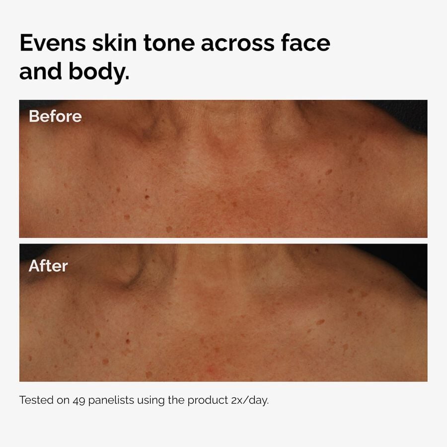 the-body-care-collection-y1 ord-niacinamide-face-body-serum-before-after-even-tone-graphic.jpg