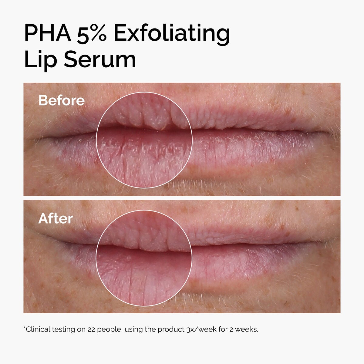 pha-5-exfoliating-lip-serum-a4 ord-pha-5pct-lip-exfoliating-serum-before-after.jpg