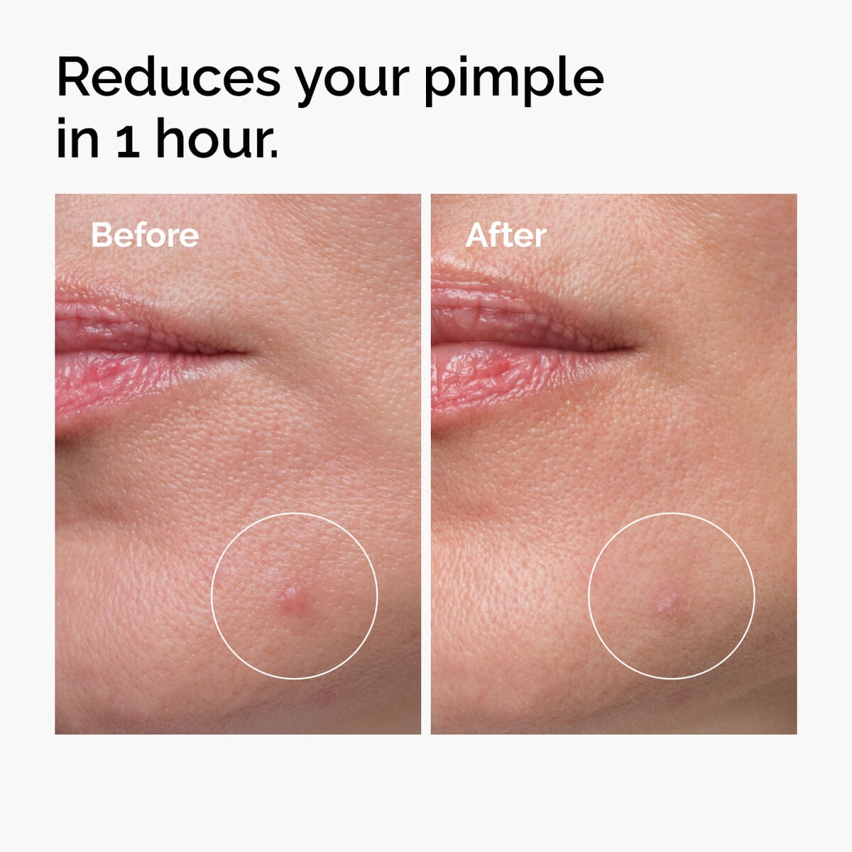 sulfur-10-powder-to-cream-concentrate-i7 ord-sulfur-10pct-powder-to-cream-concentrate-before-after-NA.jpg