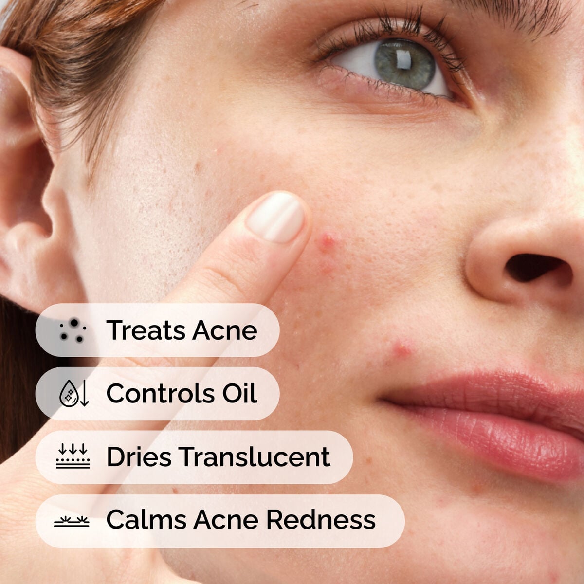 sulfur-10-powder-to-cream-concentrate-i7 ord-sulfur-10pct-powder-to-cream-concentrate-model-application-with-benefits-acne.jpg